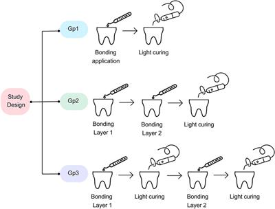 Effect of double adhesive layer application on micro-tensile dentin bond strength of a universal adhesive